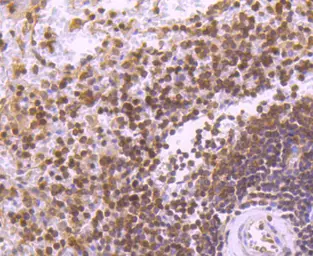 Anti-STAT5B antibody [SD08-08] used in IHC (Paraffin sections) (IHC-P). GTX01153