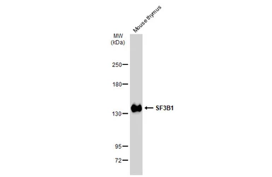 Anti-SF3B1 antibody [JB40-32] used in Western Blot (WB). GTX01165