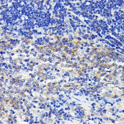 Anti-ATG7 antibody [GT1218] used in IHC (Paraffin sections) (IHC-P). GTX01526