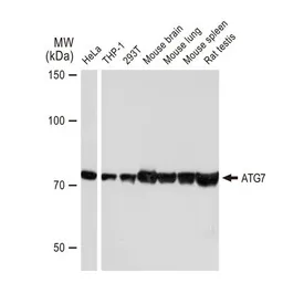 Anti-ATG7 antibody [GT1218] used in Western Blot (WB). GTX01526