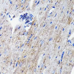 Anti-Cathepsin D antibody [GT1232] used in IHC (Paraffin sections) (IHC-P). GTX01540