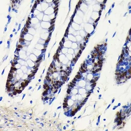 Anti-SOX9 antibody [GT1219] used in IHC (Paraffin sections) (IHC-P). GTX01545