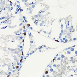 Anti-SOX9 antibody [GT1219] used in IHC (Paraffin sections) (IHC-P). GTX01545