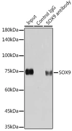 Anti-SOX9 antibody [GT1219] used in Immunoprecipitation (IP). GTX01545