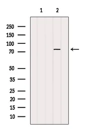 Anti-PARP2 antibody used in Western Blot (WB). GTX01558