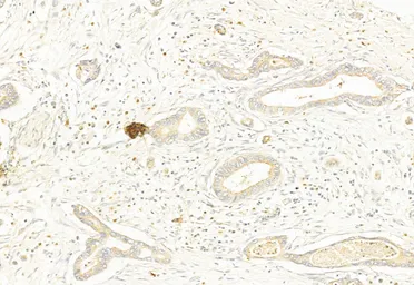 Anti-DRP1 (phospho Ser637) antibody used in IHC (Paraffin sections) (IHC-P). GTX01567