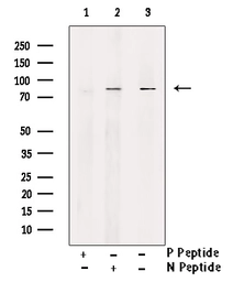 Anti-DRP1 (phospho Ser637) antibody used in Western Blot (WB). GTX01567
