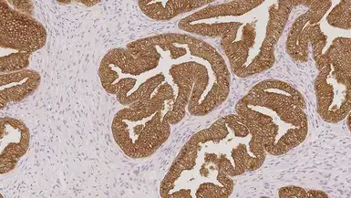 Anti-PSA antibody [35H9] used in IHC (Paraffin sections) (IHC-P). GTX01887