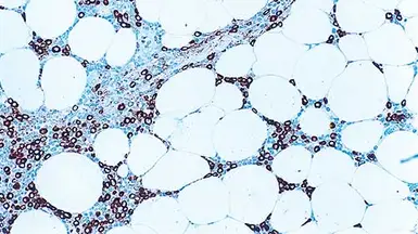 Anti-Myeloperoxidase antibody [59A5] used in IHC (Paraffin sections) (IHC-P). GTX01896
