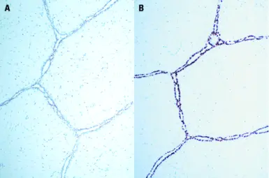 Anti-Progesterone Receptor antibody [16 + SAN27] used in IHC (Paraffin sections) (IHC-P). GTX01924