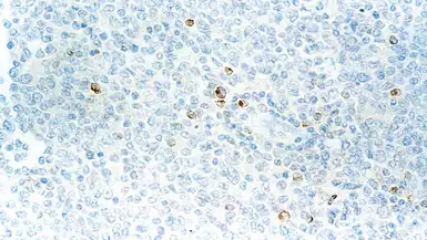 Anti-Perforin antibody [5B10] used in IHC (Paraffin sections) (IHC-P). GTX01949