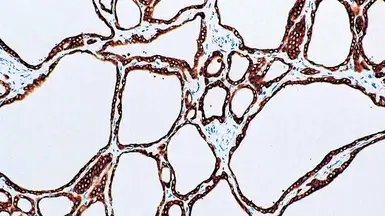 Anti-TPO antibody [AC25] used in IHC (Paraffin sections) (IHC-P). GTX01955