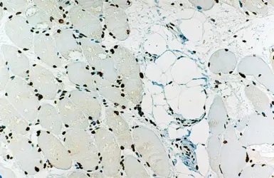 Anti-Emerin antibody [4G5] used in IHC (Paraffin sections) (IHC-P). GTX01975