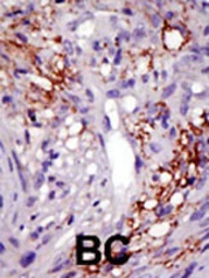 Anti-USP22 antibody used in IHC (Paraffin sections) (IHC-P). GTX02528