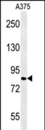 Anti-CPEB4 antibody used in Western Blot (WB). GTX02529