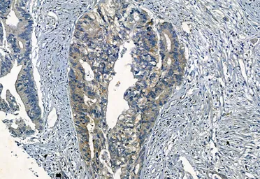 Anti-Smoothened homolog antibody used in IHC (Paraffin sections) (IHC-P). GTX02530