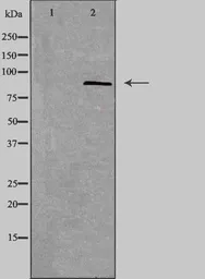 Anti-Smoothened homolog antibody used in Western Blot (WB). GTX02530