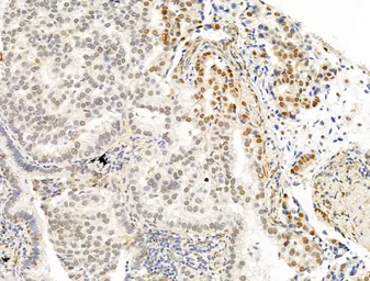Anti-PPAR gamma (phospho Ser112) antibody used in IHC (Paraffin sections) (IHC-P). GTX02531