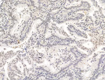 Anti-PPAR gamma (phospho Ser112) antibody used in IHC (Paraffin sections) (IHC-P). GTX02531