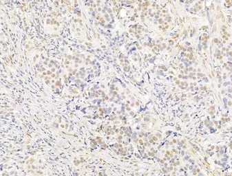 Anti-PPAR gamma (phospho Ser112) antibody used in IHC (Paraffin sections) (IHC-P). GTX02531
