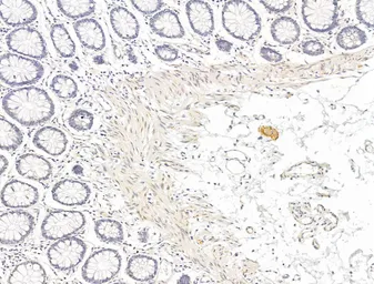 Anti-PPAR gamma (phospho Ser112) antibody used in IHC (Paraffin sections) (IHC-P). GTX02531