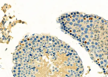 Anti-REV3L antibody used in IHC (Paraffin sections) (IHC-P). GTX02533