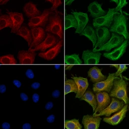 Anti-alpha Synuclein (phospho Ser129) antibody used in Immunocytochemistry/ Immunofluorescence (ICC/IF). GTX02537