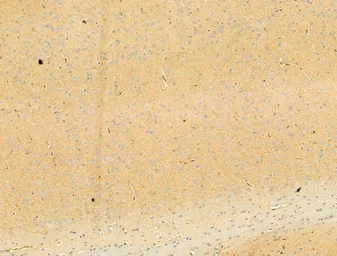 Anti-alpha Synuclein (phospho Ser129) antibody used in IHC (Paraffin sections) (IHC-P). GTX02537