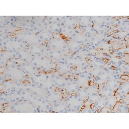 Anti-alpha Synuclein (phospho Ser129) antibody used in IHC (Paraffin sections) (IHC-P). GTX02537