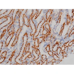 Anti-alpha Synuclein (phospho Ser129) antibody used in IHC (Paraffin sections) (IHC-P). GTX02537