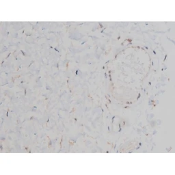 Anti-alpha Synuclein (phospho Ser129) antibody used in IHC (Paraffin sections) (IHC-P). GTX02537