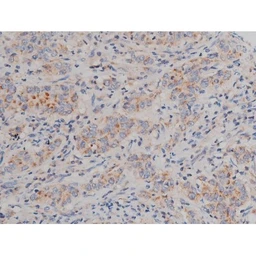 Anti-alpha Synuclein (phospho Ser129) antibody used in IHC (Paraffin sections) (IHC-P). GTX02537