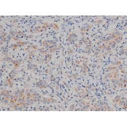 Anti-alpha Synuclein (phospho Ser129) antibody used in IHC (Paraffin sections) (IHC-P). GTX02537