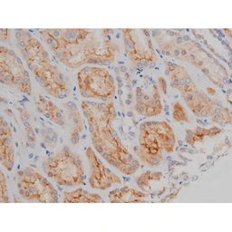 Anti-alpha Synuclein (phospho Ser129) antibody used in IHC (Paraffin sections) (IHC-P). GTX02537