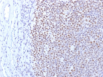 Anti-DNMT1 antibody [DNMT1/2061] used in IHC (Paraffin sections) (IHC-P). GTX02546