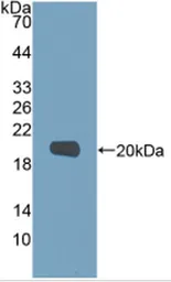 Human MMP9 protein, His tag (Active). GTX02551-pro