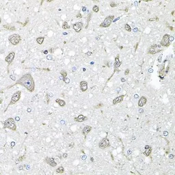 Anti-FGF1 antibody used in IHC (Paraffin sections) (IHC-P). GTX02555