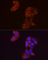 Anti-FGF1 antibody used in Immunocytochemistry/ Immunofluorescence (ICC/IF). GTX02555