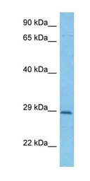 Anti-CDC4 antibody used in Western Blot (WB). GTX02557