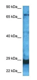 Anti-CDC4 antibody used in Western Blot (WB). GTX02557