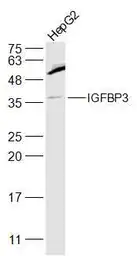 Anti-IGFBP3 antibody used in Western Blot (WB). GTX02574