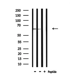 Anti-NOX1 antibody used in Western Blot (WB). GTX02577
