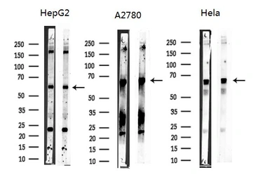 Anti-NOX1 antibody used in Western Blot (WB). GTX02577