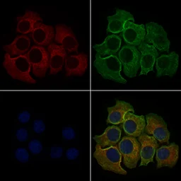 Anti-PLCE1 antibody used in Immunocytochemistry/ Immunofluorescence (ICC/IF). GTX02580