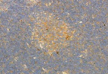 Anti-PLCE1 antibody used in IHC (Paraffin sections) (IHC-P). GTX02580