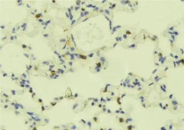 Anti-PLCE1 antibody used in IHC (Paraffin sections) (IHC-P). GTX02580