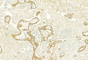 Anti-PLCE1 antibody used in IHC (Paraffin sections) (IHC-P). GTX02580