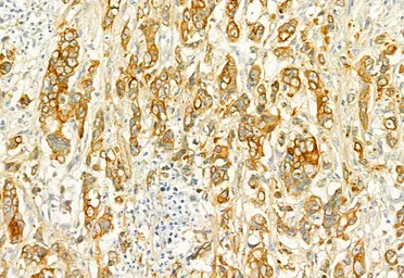 Anti-PLCE1 antibody used in IHC (Paraffin sections) (IHC-P). GTX02580