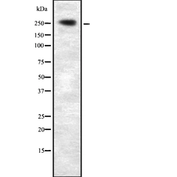 Anti-PLCE1 antibody used in Western Blot (WB). GTX02580