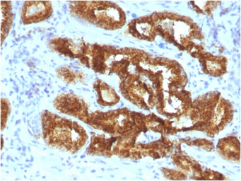 Anti-AMACR antibody [AMACR/3931R] used in IHC (Paraffin sections) (IHC-P). GTX02587